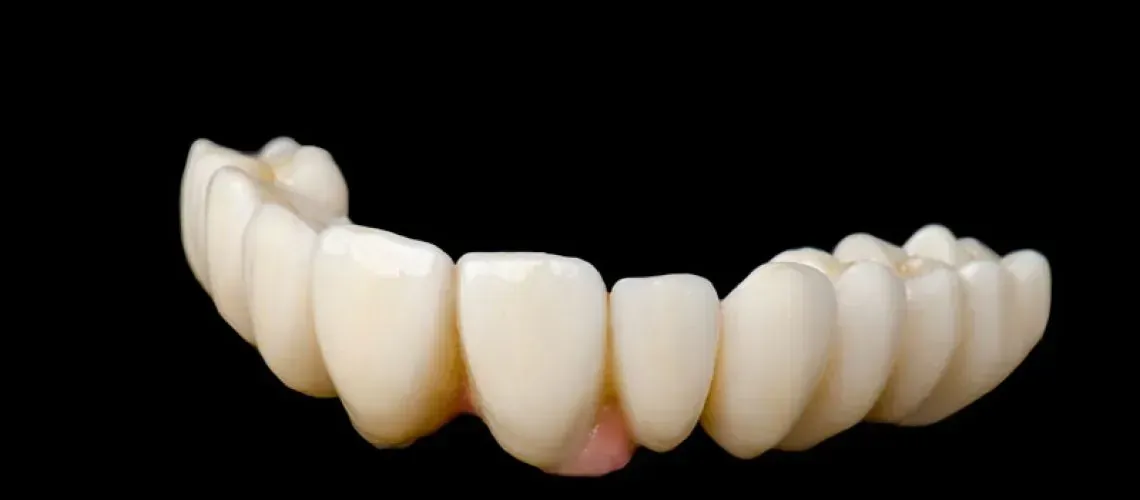 Lower Full Arch Implant Model
