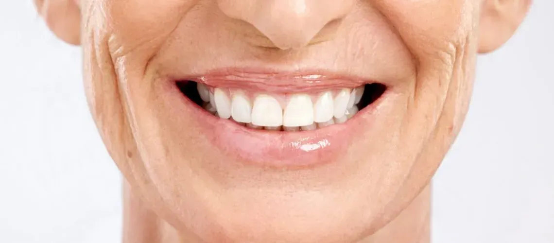 Advanced Teethxpress Smile