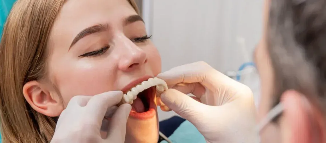 Dental-Implant Benefits