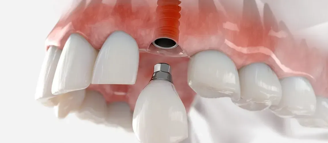 Dental X-Ray Consultation