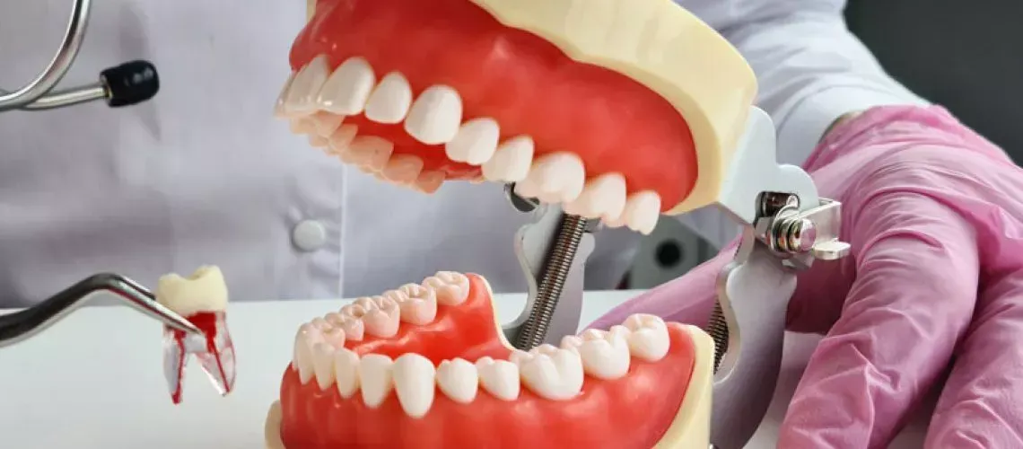 Implants After Tooth Extraction