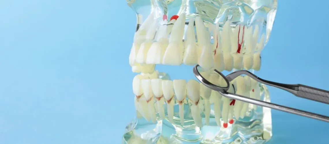 Surgeon Preparing Dental Implant