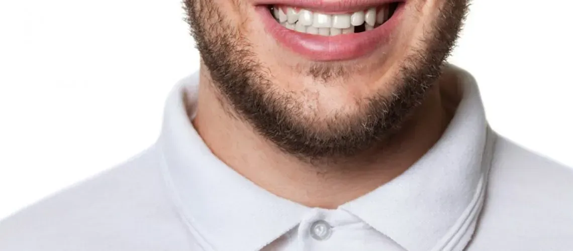 From shifting teeth to jawbone loss, missing teeth cause more problems than you think. Discover 5 reasons why replacing them now is essential for your oral health.