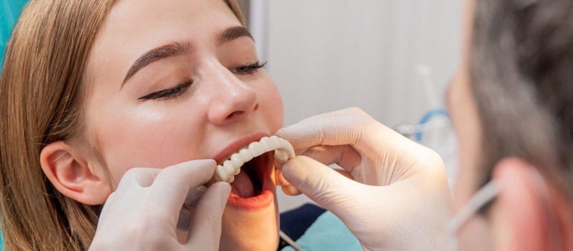 a picture of an oral surgeon placing a temporary prosthesis in the patients mouth during her advanced TeethXpress procedure.