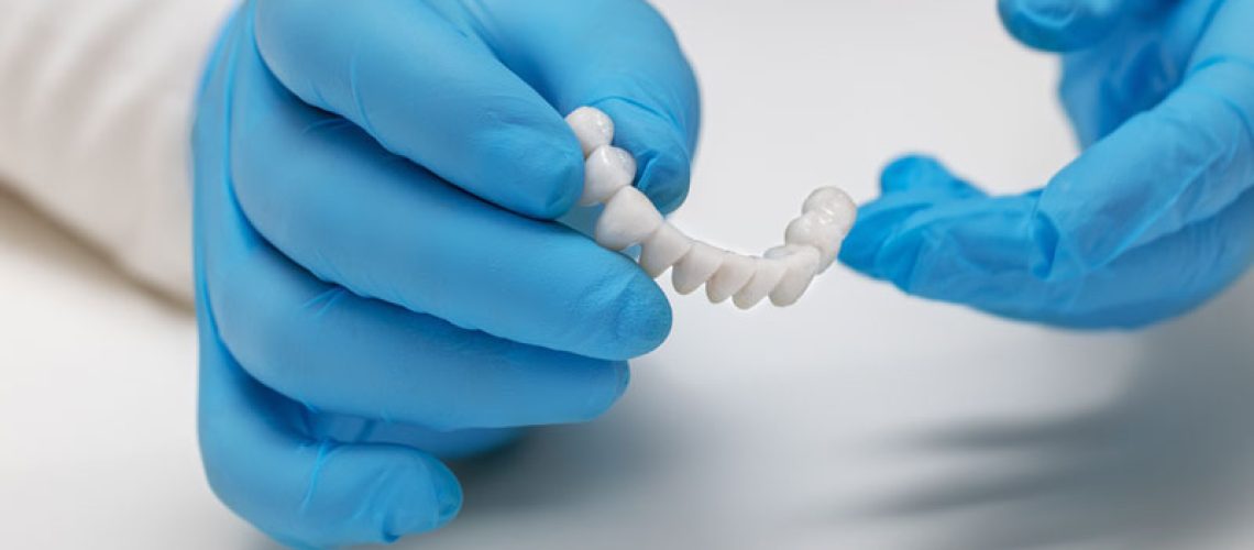 a picture of a doctor holding a full mouth dental implant prosthetic after he has prepared the patients mouth for a full mouth dental implant procedure with a bone grafting treatment.