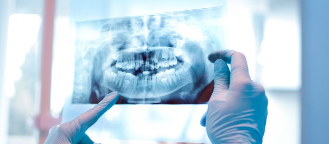 Close-up of female doctor pointing at teeth x-ray image at dental office.